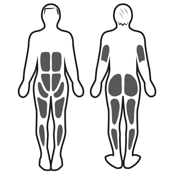 Stimolazione muscolare