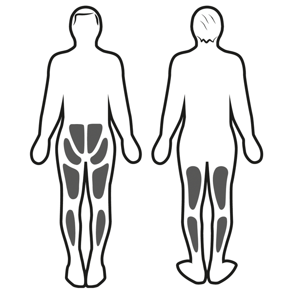 Stimolazione muscolare